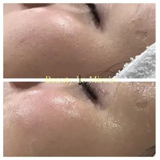 ビューティー ミロワールのエステ・リラクイメージ