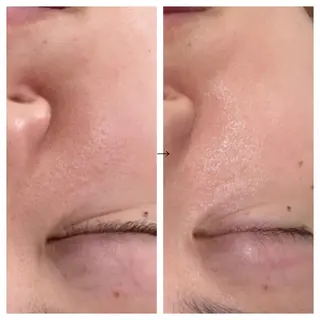 ビューティー ミロワールのエステ・リラクイメージ