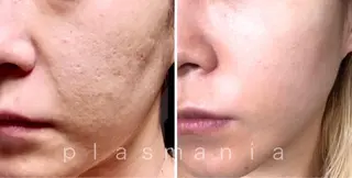 private salon éclat所属・ニキビ・毛穴専門 éclat/エクラのエステ・リラクイメージ