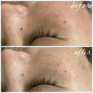 メンズ メナード岐阜茜部 杉浦のエステ・リラクイメージ