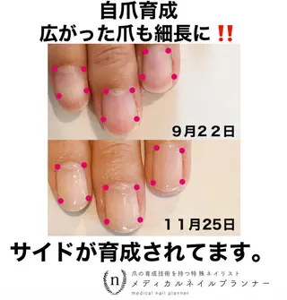 ネイル NAIL SALON ｔｏｇｇｙのネイルデザイン