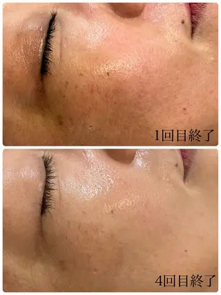 温活美肌専門サロン Lien『リアン』のエステ・リラクイメージ