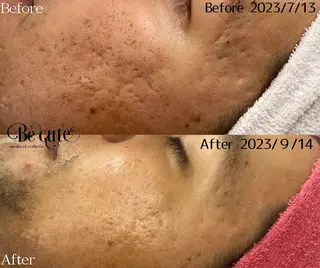 メンズ the 別嬪 静岡店所属・the 別嬪 静岡店のエステ・リラクイメージ