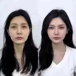 ネイル aliaハイフ&水光ジェットサロン所属・aliaハーブ水光店 エステティシャン募集のエステ・リラクイメージ