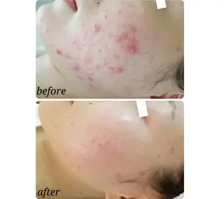 石井 つかさのエステ・リラクイメージ