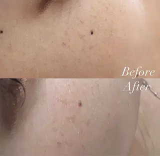 Cheri所属・丸山 彩乃のエステ・リラクイメージ