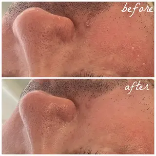 メンズ メナード岐阜市茜部 杉浦のエステ・リラクイメージ