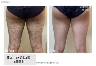 メンズ トータルクリア 田岡のエステ・リラクイメージ