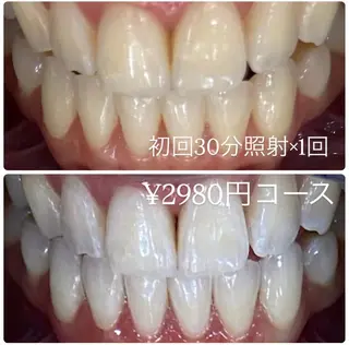 PLATINUM Beauty 横浜店所属・ホワイトニングルーム 横浜店のその他イメージ