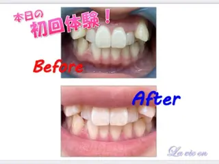 セルフホワイトニングサロン　ラヴィアン所属・ホワイトニングサロン La vie enのその他イメージ