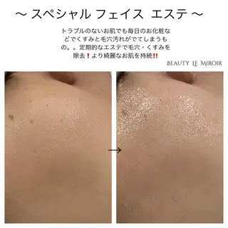 ビューティー ミロワールのエステ・リラクイメージ