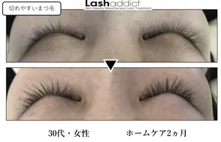 マツエク・マツパ アイブロウ ♾nail 恵美のマツエク・マツパデザイン