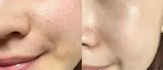 エステサロン lindyのエステ・リラクイメージ