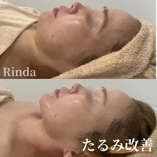 ブライダル痩身×脱毛 尼崎駅前サロンのエステ・リラクイメージ