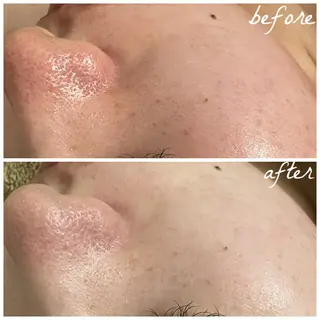 メンズ メナード岐阜茜部 杉浦のエステ・リラクイメージ