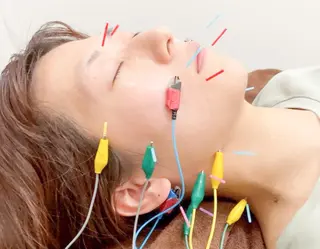 【美容鍼・小顔鍼】 鍼灸師　吉田洋美のエステ・リラクイメージ