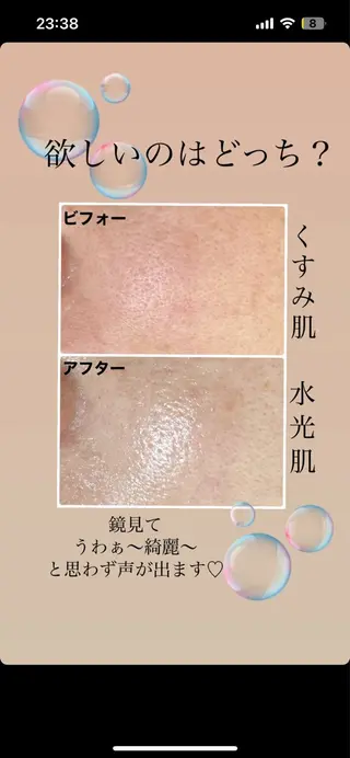 お肌と歯のサロン　Sona Mior所属・藤井 ののみのエステ・リラクイメージ