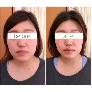 美容整骨・アロマリンパ【kilie】キリー所属・大人の女性の為の 美容整体矯正💎のエステ・リラクイメージ