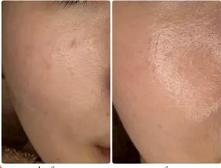 ショート aliaハイフ&水光ジェットサロン所属・aliaハーブ水光店 エステティシャン募集のエステ・リラクイメージ