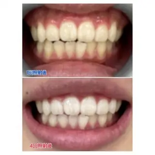 M渋谷店所属・Ｍ渋谷 ホワイトニングのエステ・リラクイメージ