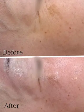 Hisui 種村のエステ・リラクイメージ