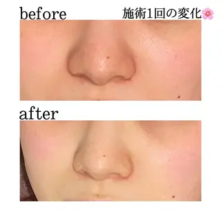 ショート カラー パーマ ヘアアレンジ メンズ キッズ ネイル マツエク・マツパ アイブロウ ニキビ特化型エステ 🍓最短で肌質改善のエステ・リラクイメージ