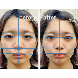 小顔矯正NAKA 筋膜/脂肪/毛穴洗浄のエステ・リラクイメージ