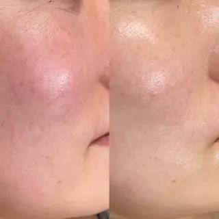 emma所属・emma MINORIのエステ・リラクイメージ