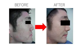 肌質改善専門サロン ／FSS渋谷店　松本のエステ・リラクイメージ