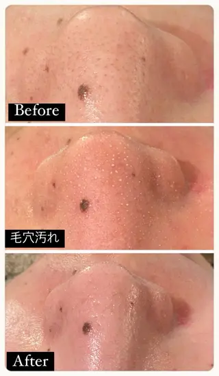 ホワイトニング ショップ吉祥寺2号店のその他イメージ