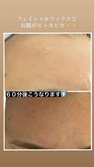 美肌脱毛fuu okinawa所属・宜野湾美肌脱毛fuu okinawaタイラのエステ・リラクイメージ