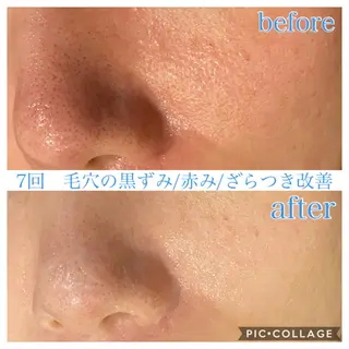 ショート カラー パーマ ヘアアレンジ メンズ ネイル マツエク・マツパ Ensor Clair所属・EnsorClair 代表　野口真央のエステ・リラクイメージ