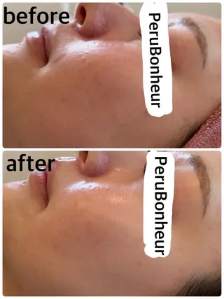 美肌管理サロン　ペルボヌール所属・韓国美肌管理サロン ペルボヌールのエステ・リラクイメージ