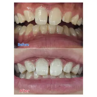 MBEAUTYSALON 千葉店・京成大久保所属・Melty 輝のその他イメージ