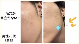 シミシワタルミ改善 美肌サロン松本浩美のエステ・リラクイメージ