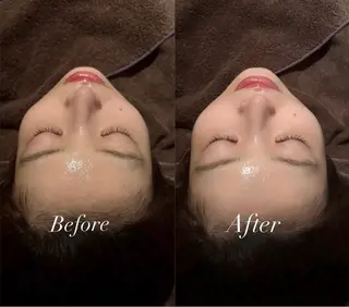 🌼美肌専門 肌質改善🌼のエステ・リラクイメージ