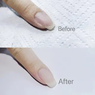 ミディアム ネイル フィルイン、長さ出し 深爪矯正のネイルデザイン