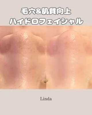 アイラッシュ&エステサロンLinda西宮所属・小顔&毛穴・肌質改善 LINDA西宮 AIのエステ・リラクイメージ