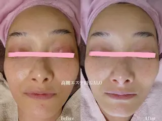 REGALO所属・矢野 さやかのエステ・リラクイメージ