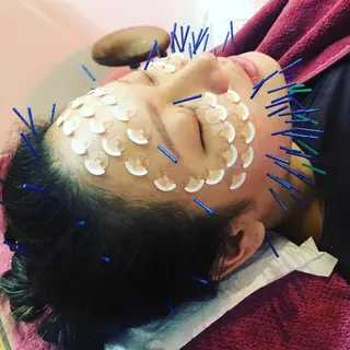 美容鍼灸女性専用 りんご鍼灸治療院のエステ・リラクイメージ