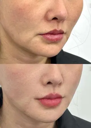 ネイル aliaハイフ&水光ジェットサロン所属・aliaハーブ水光店 エステティシャン募集のエステ・リラクイメージ