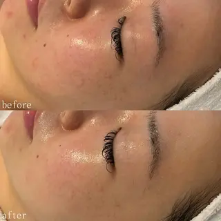 デ・アイム心斎橋所属・肌質改善サロン🫧 MAIのエステ・リラクイメージ