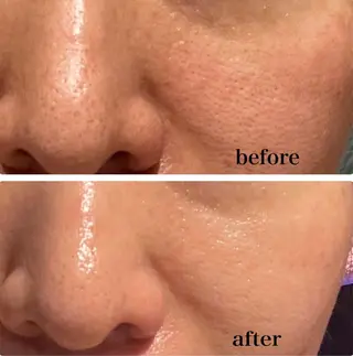 調律エステ /美KISSのその他イメージ