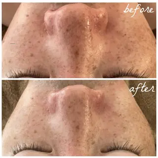 メンズ メナード岐阜市茜部 杉浦のエステ・リラクイメージ