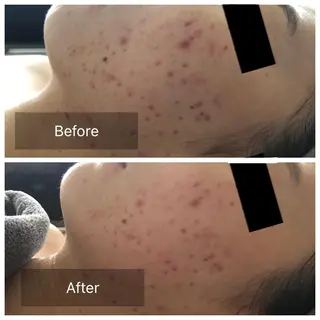 Radiance H.Oのエステ・リラクイメージ