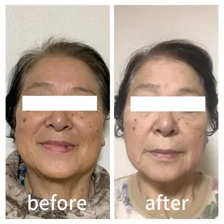 小顔サロン AMYONのエステ・リラクイメージ