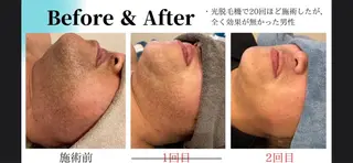 CHERIMO【lalaLaLa】所属・CHERIMO シェリモのネイルデザイン