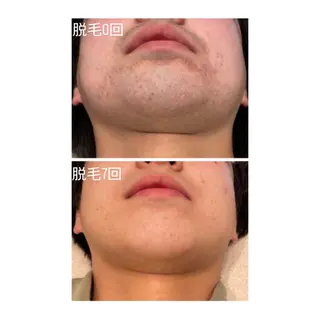 TotalBeautySalon UNCHEL所属・Ito ayakaのマツエク・マツパデザイン