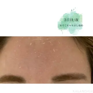 肌質改善 KALANCHOEのエステ・リラクイメージ