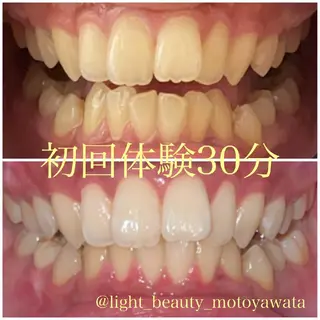 五十嵐 蓮のその他イメージ